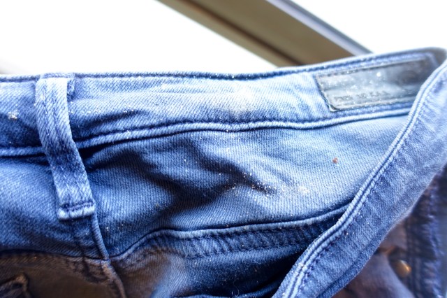 goldie looking flakes on my pants